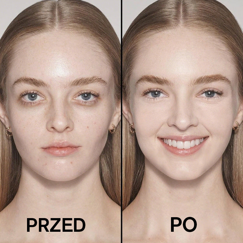 💕 Lahka vlažilna podlaga (s podlago v stiku)-SI