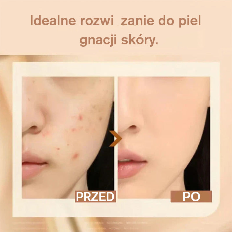 💕 Lahka vlažilna podlaga (s podlago v stiku)-SI