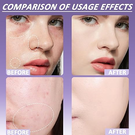 🔥 Kupite jedan, drugi dobijete gratis! 🎁 Nježni, mat kremasti korektor-HR