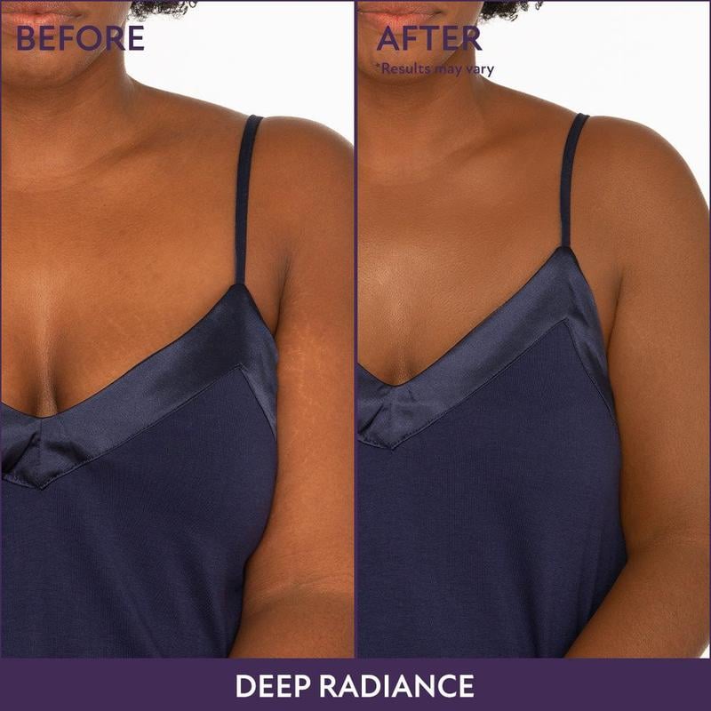 💜Zadnji dan – kupite 1, dobite 1 gratis!💜✨Body Perfector – vodoodporna, lahka in brezhibna ličila za telo-SI