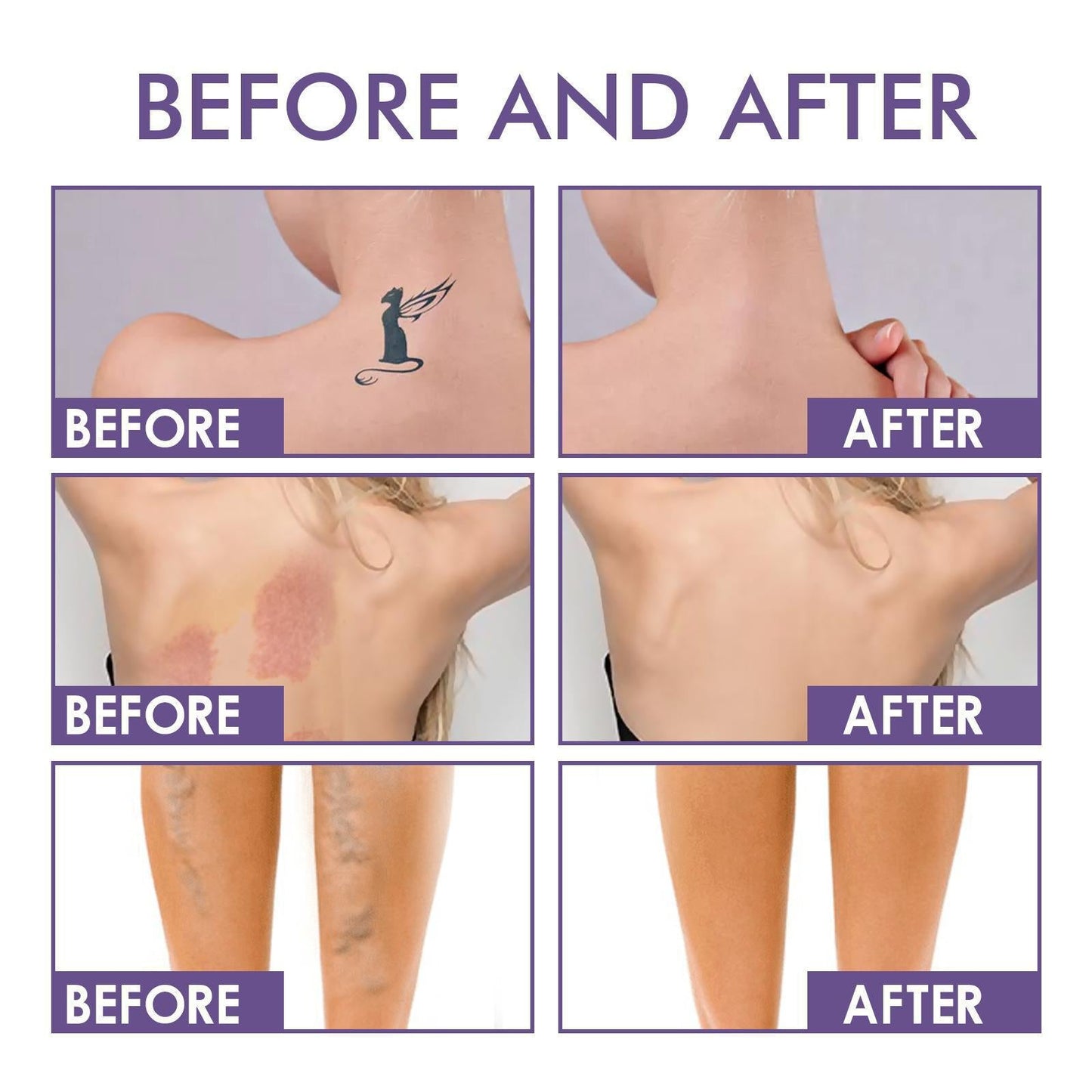 💜Zadnji dan – kupite 1, dobite 1 gratis!💜✨Body Perfector – vodoodporna, lahka in brezhibna ličila za telo-SI