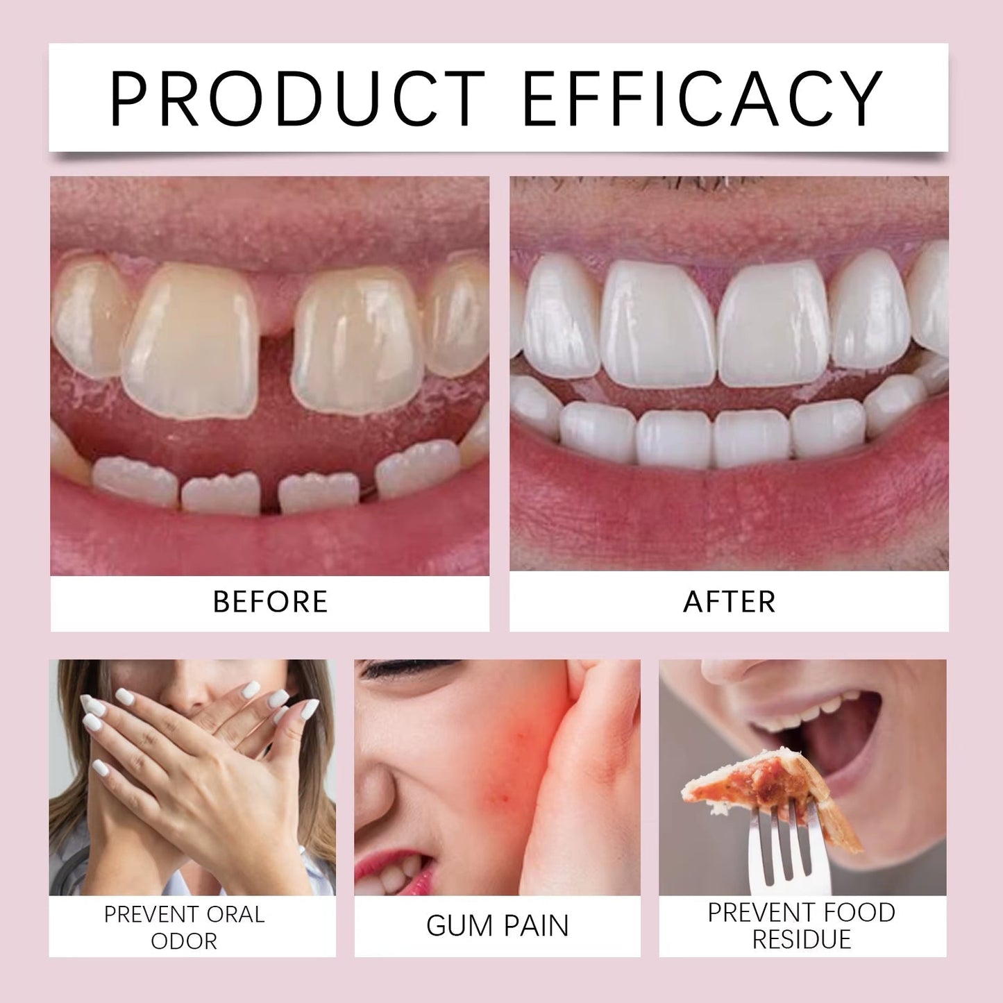 Daugiau jokių klibančių dantų protezų! Geriausiai Europoje parduodami, ilgai išliekantys dantų protezų klijai.🔥-LT