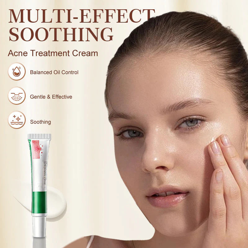 Crema calmante multifuncional para el tratamiento del acné-ES