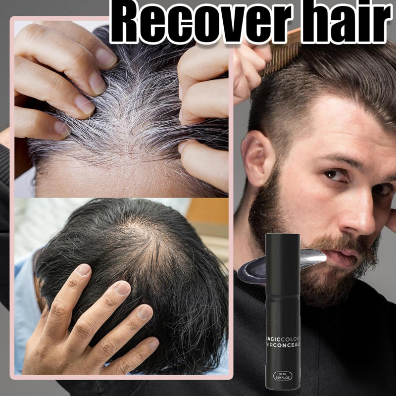 Krema za obnovo lasišča za gostejše in bolj naraven videz las-SI